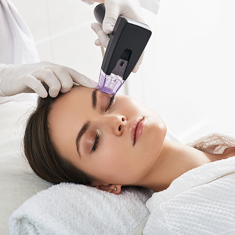 Laser Treatments